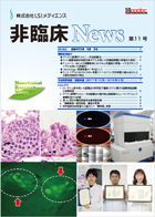 ՏNews11@2019N3s